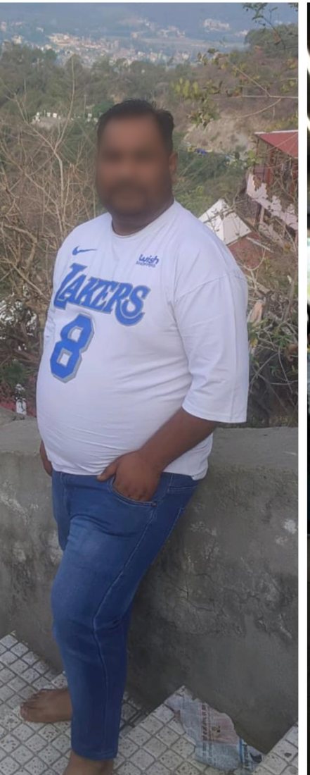 Before photo from a client fitness transformation, face softly blurred for privacy