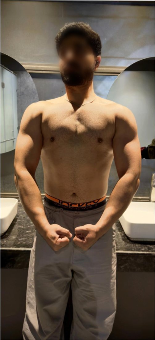 After photo from a client fitness transformation, face softly blurred for privacy