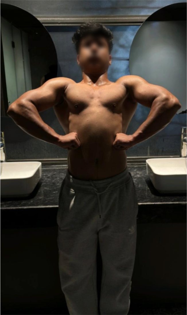 After photo from a client fitness transformation, face softly blurred for privacy