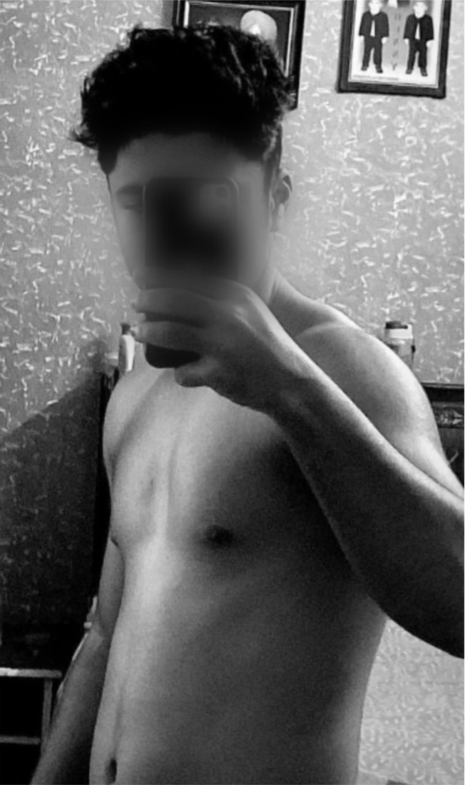 Before photo from a client fitness transformation, face softly blurred for privacy